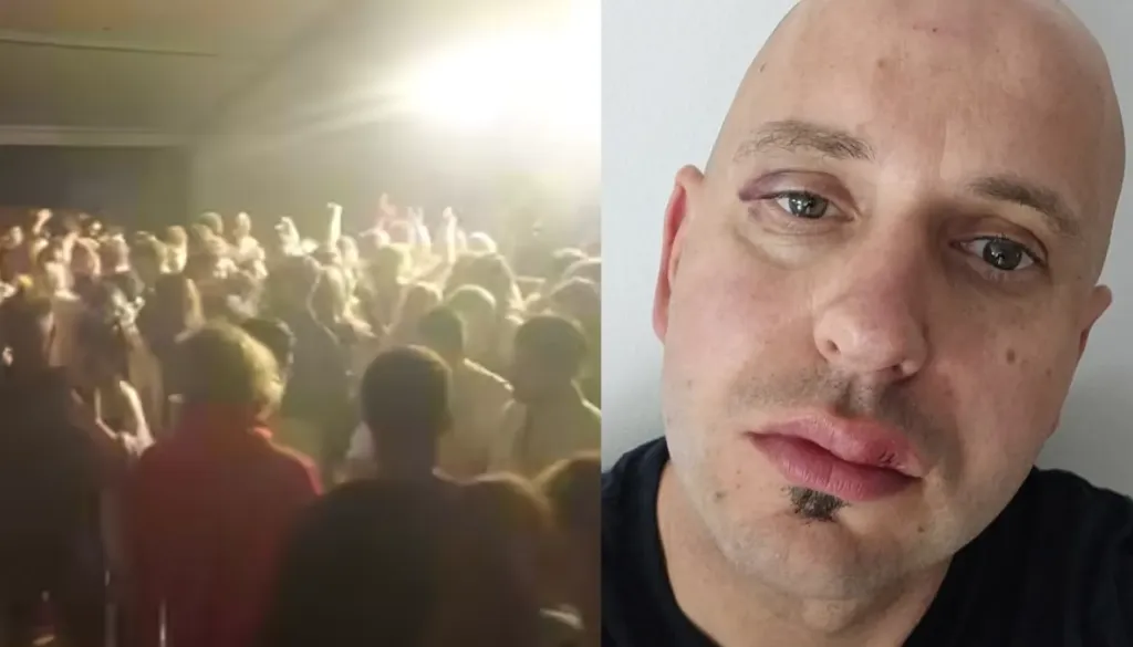 Po napadu Romov na 18-letnika v Ribnici: »Jaz in moj sin ne dobiva niti pojasnila, kaj se dogaja«