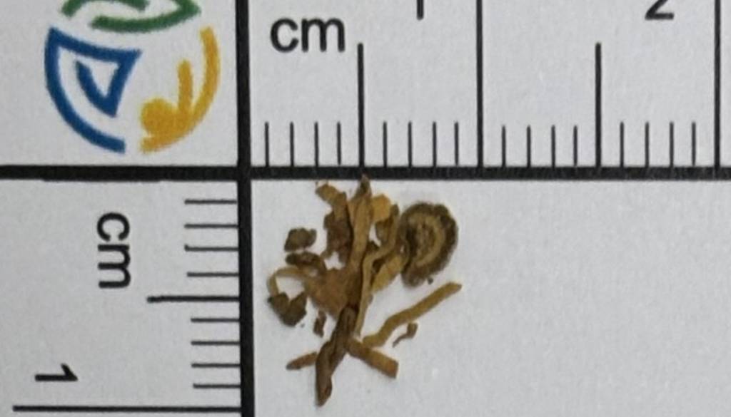 V Mariboru kupil tobak: Pomodrele so mu ustnice in ponorelo srce