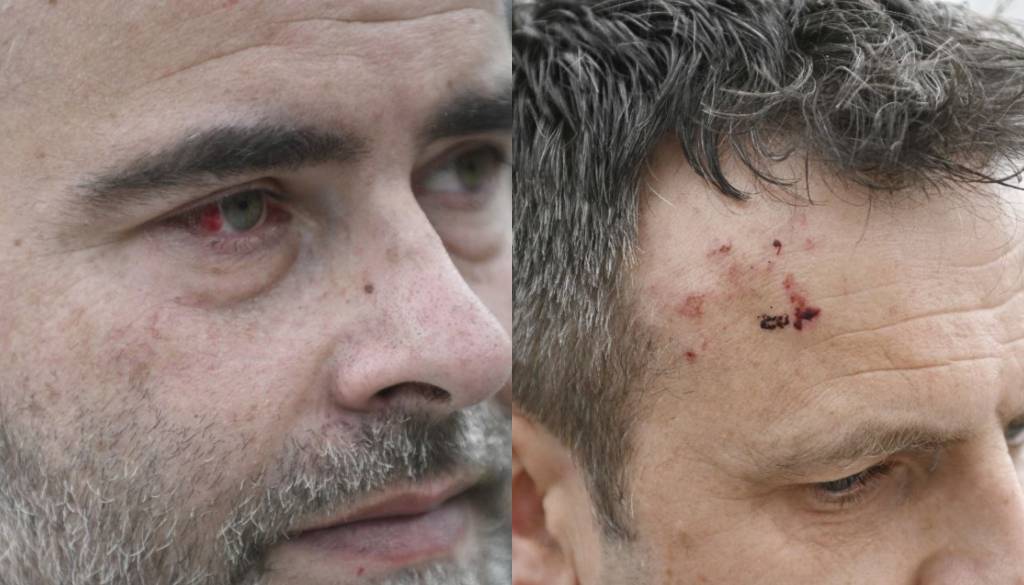 FOTO IN VIDEO: Incident pri gradnji kanala C0, lastnika zemljišča naj bi pretepli varnostniki