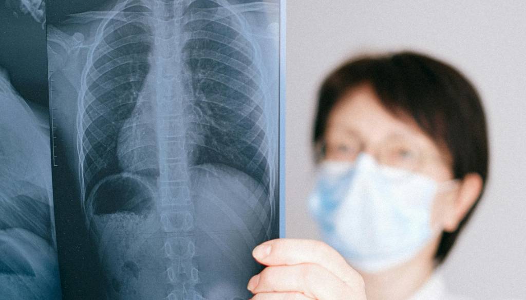 To so zdravstvene 'bombe' Kranja: Klopi, rak pljuč in otroci brez kondicije