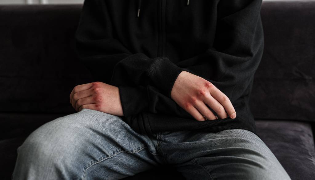 Zamaskirani moški s palicami sredi noči v Velenju napadli dva domačina