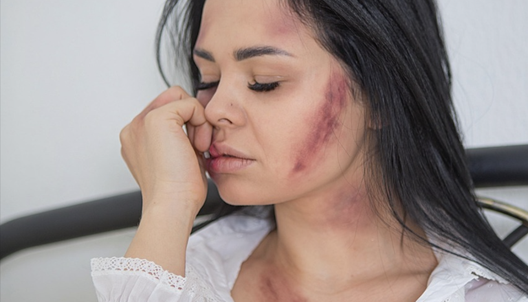 Nasilje za štirimi stenami: Policisti v enem dnevu posredovali dvakrat