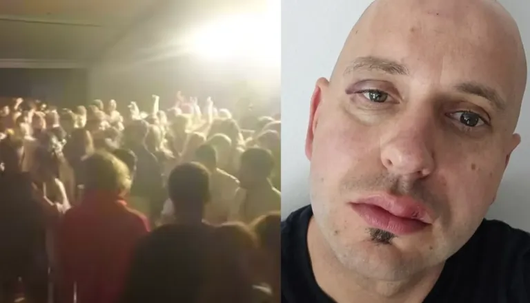 Po napadu Romov na 18-letnika v Ribnici: »Jaz in moj sin ne dobiva niti pojasnila, kaj se dogaja«