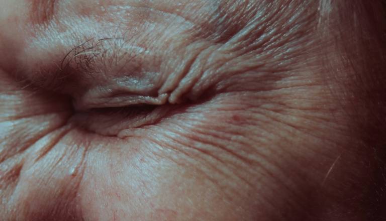 Dolgoletno nasilje v družini razkrito po poškodbi ženske