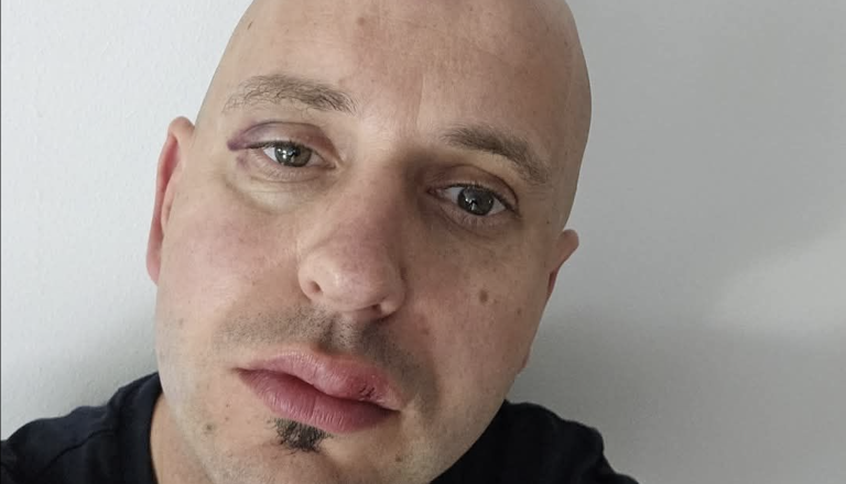 Takšna kazen je doletela mladoletnika, ki je napadel ribniškega župana