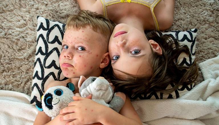 Norice: cepljeni otroci niso zboleli