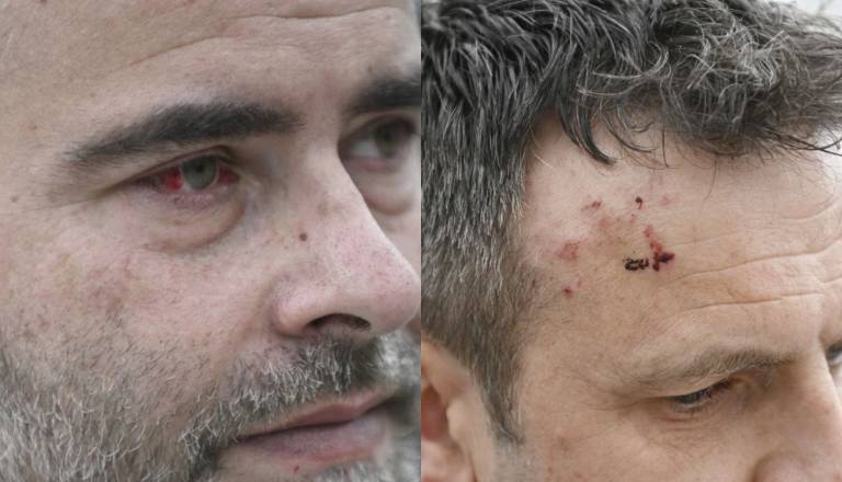 FOTO IN VIDEO: Incident pri gradnji kanala C0, lastnika zemljišča naj bi pretepli varnostniki