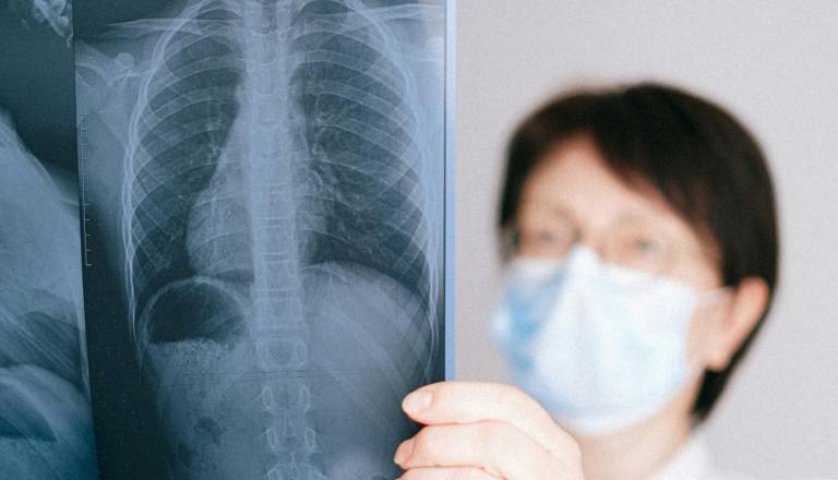 To so zdravstvene 'bombe' Kranja: Klopi, rak pljuč in otroci brez kondicije