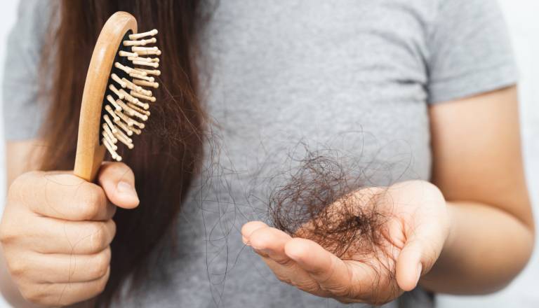 Alopecija je težava, o kateri ljudje še vedno neradi govorijo