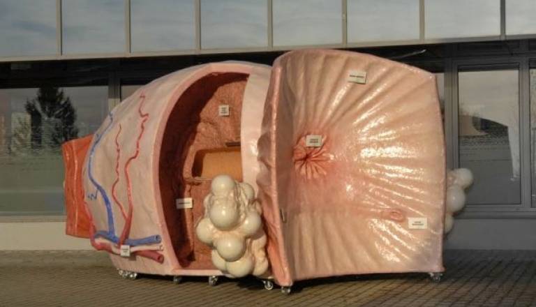 Petmetrski model prostate.jpg