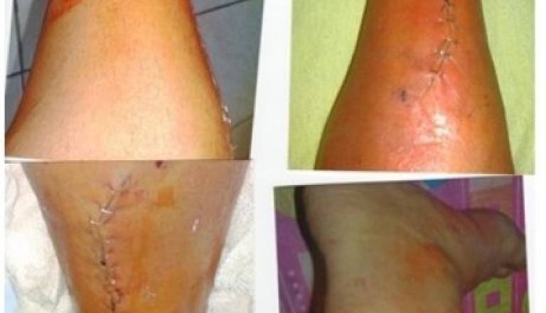 Poškodba Simona Baranje, Foto: NK Roma